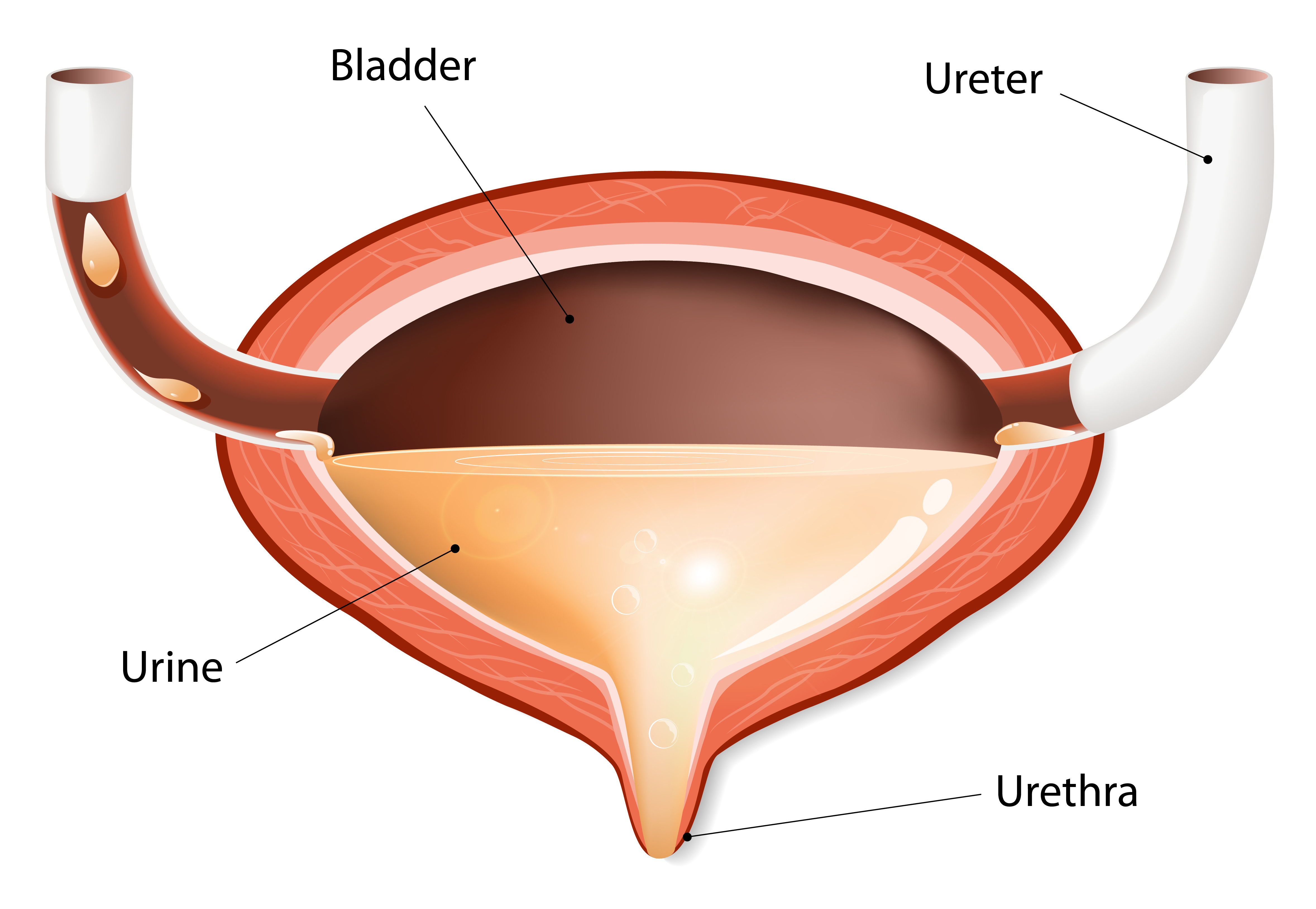 wandering bladder