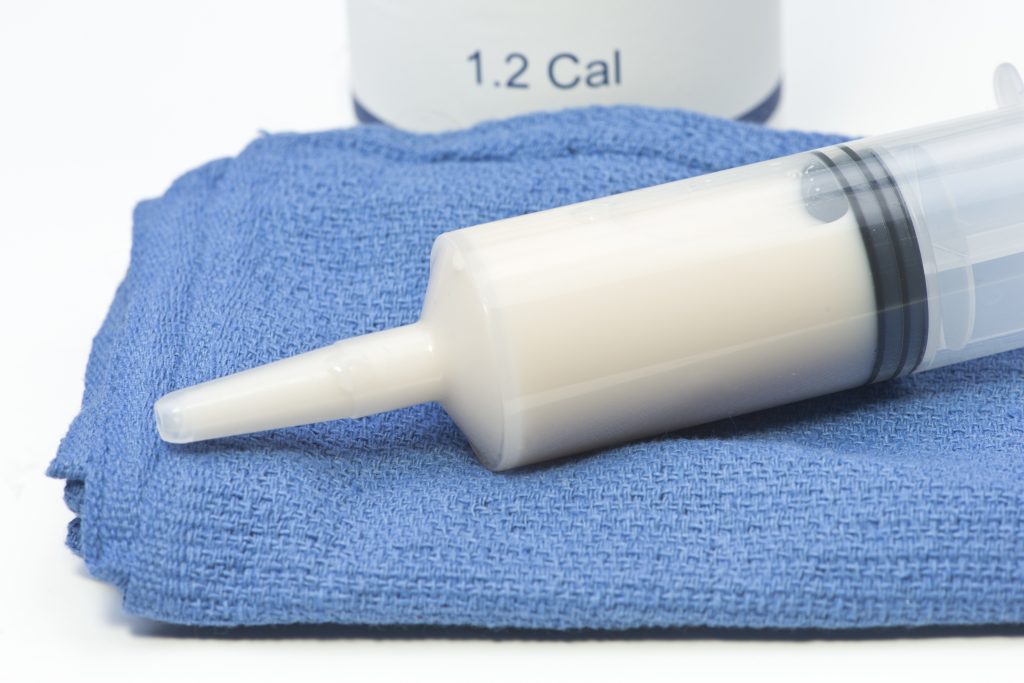 Enteral Feeding Regimens Scottish Acquired Brain Injury Network