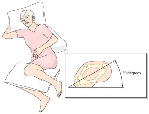 335254355-positioning-in-bed